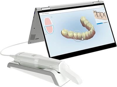 iTero scanner